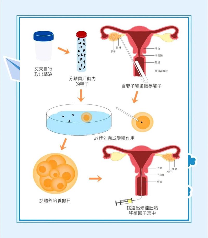 试管婴儿：解决生育难题的科学之路
